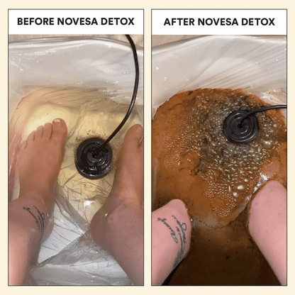 Novesa® Ionic Foot Bath
